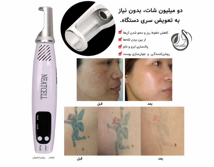 لیزر پاککننده تتو و لک NEATCELL