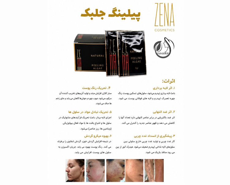 آلگاپیل زینا